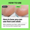 Foot Care Stick